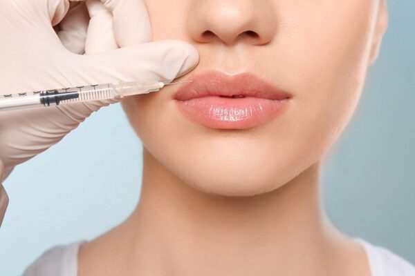 Close-up of a woman’s face as a medical professional wearing a white glove administers a lip filler injection with a syringe to enhance lip volume and shape, set against a light blue background.