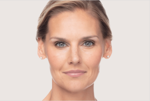 High-resolution close-up of a middle-aged woman with clear, smooth skin and subtle makeup, showcasing the results of a possible cosmetic or dermatological treatment, such as Botox, fillers, or skin rejuvenation.