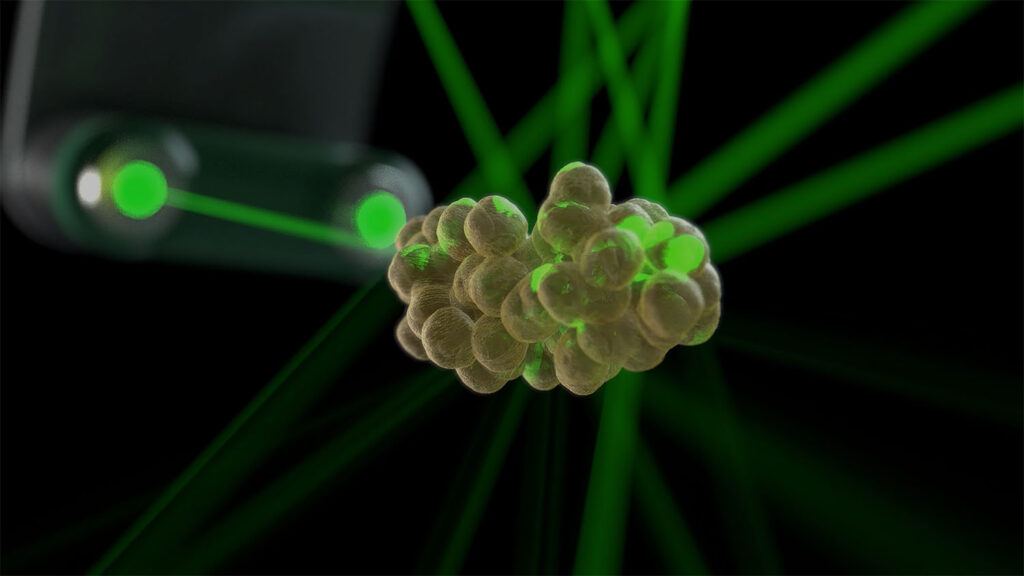 Digital rendering of a cluster of fat cells being targeted by green laser beams in a dark background, representing Emerald laser technology used for non-invasive body contouring and fat reduction procedures.