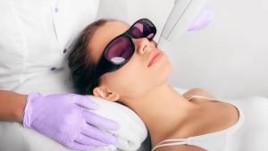 A woman wearing protective dark glasses lies back during a facial laser hair removal session. A technician in purple gloves uses a handheld laser device on the area above her upper lip, in a clean and professional clinical environment.