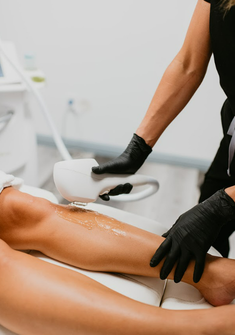 Close-up of a professional wearing black gloves performing laser hair removal on a client’s lower leg. The client is lying on a treatment bed with a clear gel applied to the skin, and a handheld laser device is in use in a modern clinical setting.
