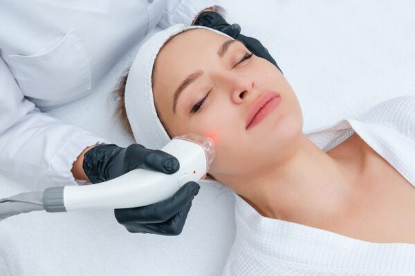 A woman lying on a treatment bed with her eyes closed receives a laser hair removal treatment on her cheek from a professional wearing black gloves, using a handheld laser device. She wears a white robe and headband in a clean, clinical environment.