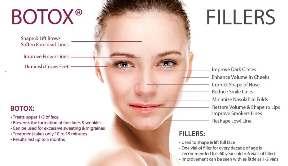 Botox vs. Dermal Fillers Treatment Guide with Facial Diagram