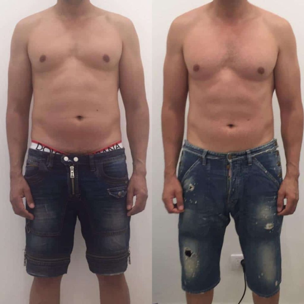 Before and after front view of a man’s torso and upper body transformation. In the "before" photo on the left, there is mild abdominal fat and softer muscle tone. In the "after" photo on the right, the stomach appears flatter and the upper body more defined, indicating muscle toning and fat reduction.