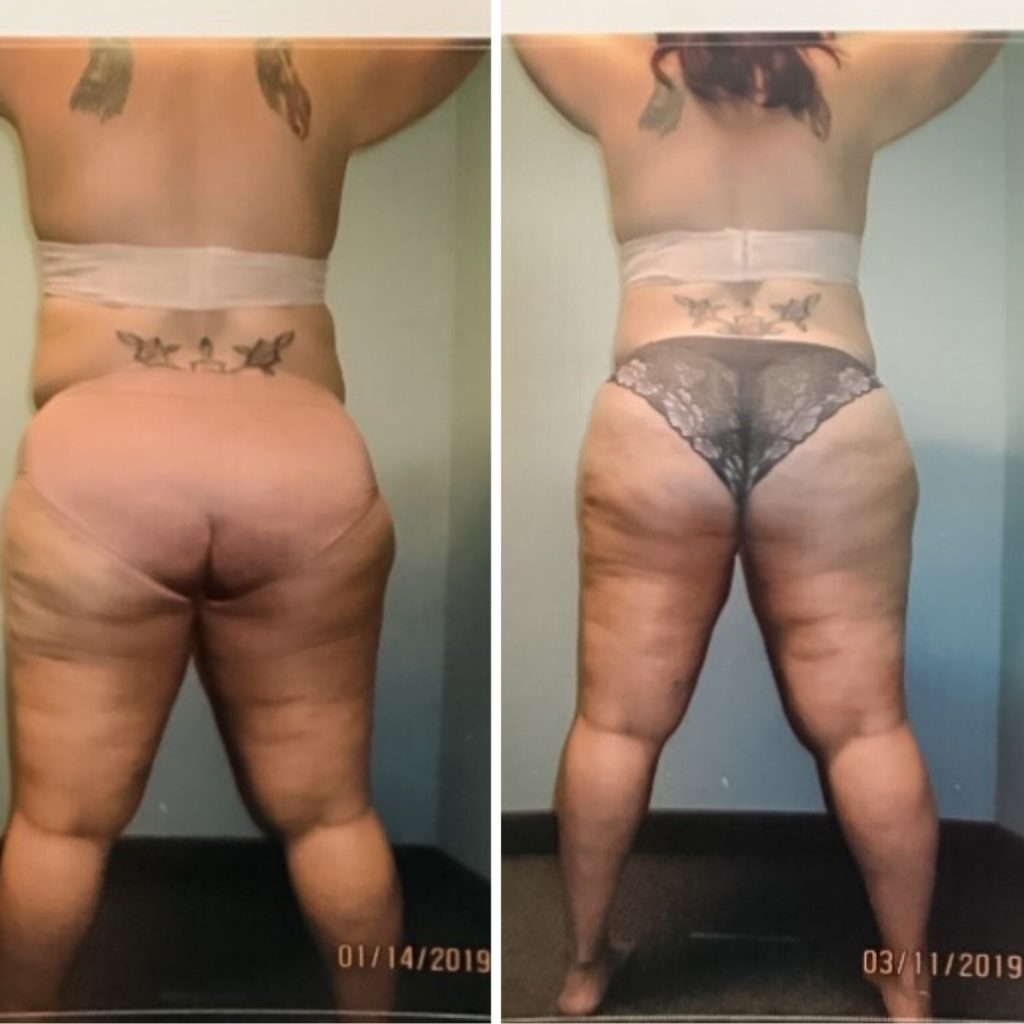 A side-by-side comparison of a woman’s back and lower body taken from behind, showing visible changes in fat distribution and muscle tone between two dates. The first photo, dated 01/14/2019, shows more volume in the hips and thighs, while the second, dated 03/11/2019, displays a leaner and more contoured shape.