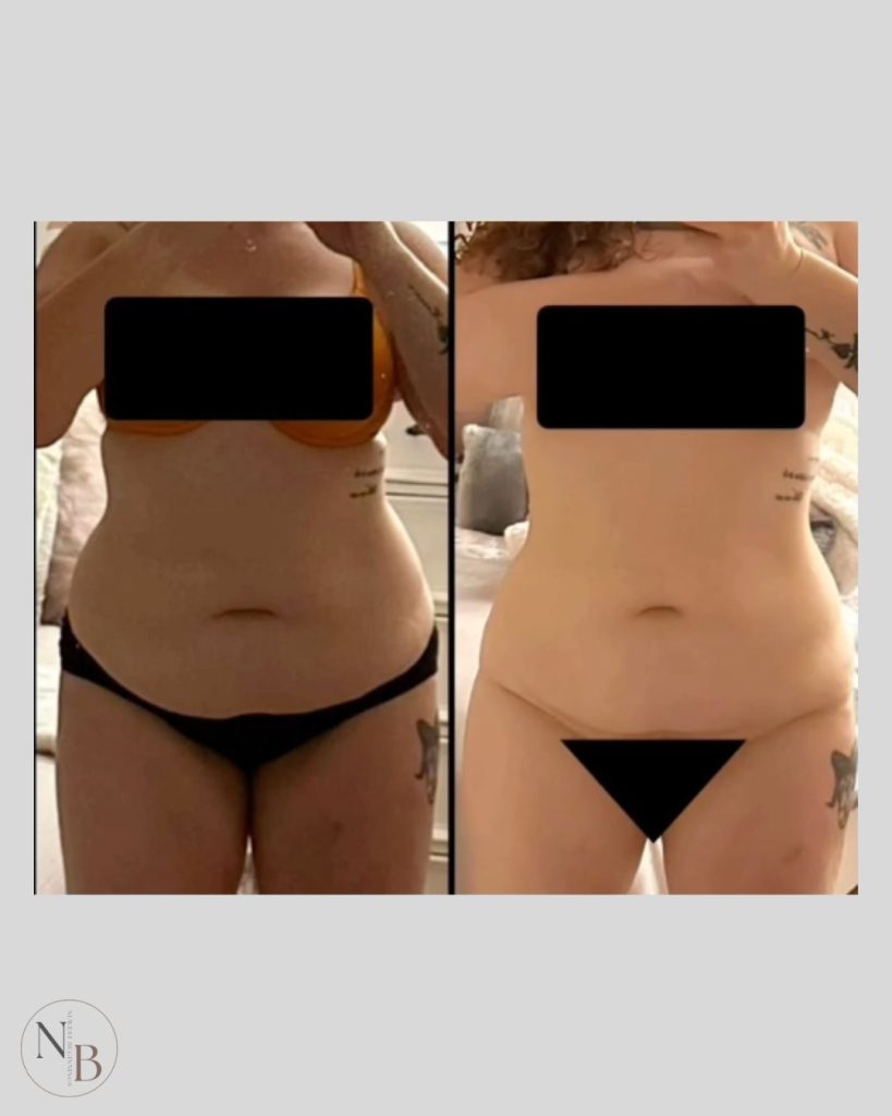 weight loss before and after (4)